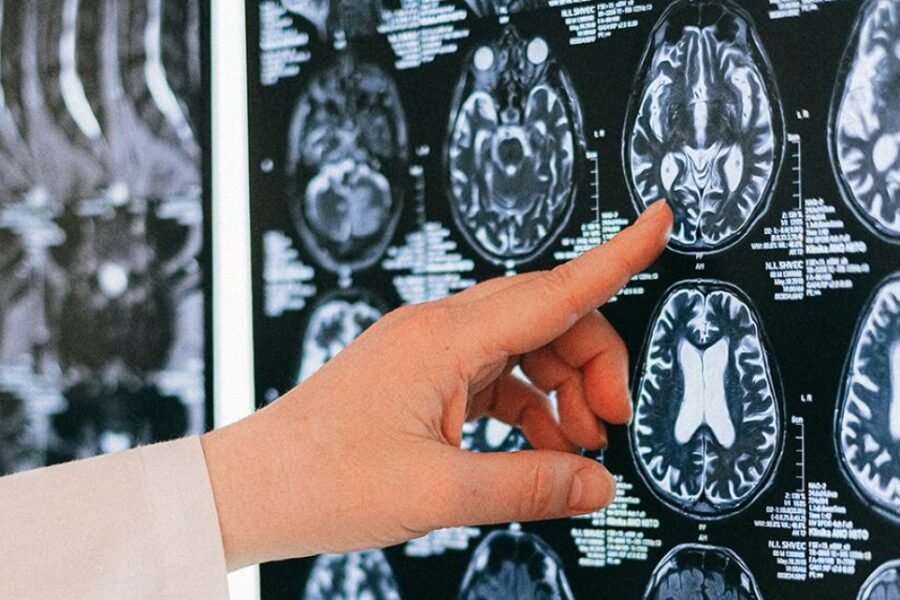 Neurocirujanos detienen atención a afiliados de Ioscor y reciben críticas por parte del Gobierno