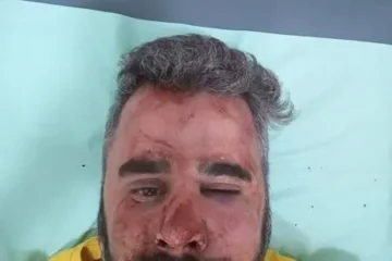 Brutal golpiza al presidente del Partido Libertario en Entre Ríos