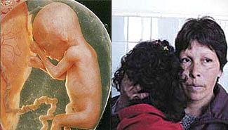 El bebé tiene 16 semanas. La abuela quiere el aborto. El abuelo no