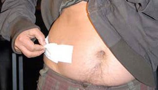 Hirieron un manifestante que estaba pegado a De Angeli