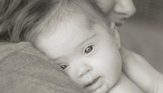 Síndrome de Down: lanzan una campaña nacional contra la discriminación