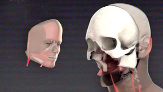 Realizaron el primer transplante total de cara del mundo