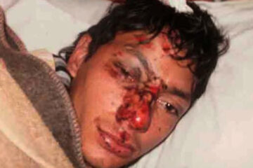 Joven denunció una golpiza policial