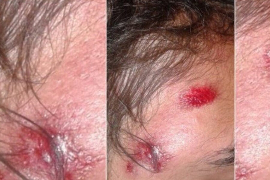 Ocho policías presos por torturar a un chico: “Guanaco, dejá de estar escupiendo” (en Entre Ríos)