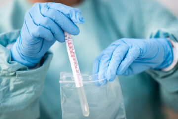 Confirmación de caso positivo de coronavirus