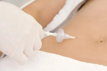 Entre Ríos: una mujer murió mientras se hacía un tratamiento estético