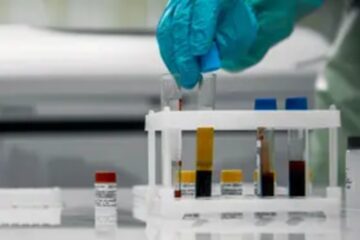 Entre Ríos registró 287 nuevos casos