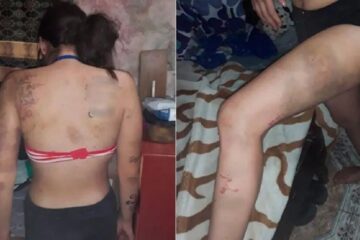 La secuestraron cuando iba a la casa de una amiga: abusaron de ella y la quemaron por seis días (sucedió en Paraná)