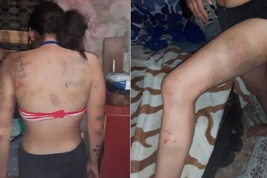 La secuestraron cuando iba a la casa de una amiga: abusaron de ella y la quemaron por seis días (sucedió en Paraná)