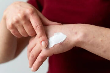 (Mención a localidad entrerriana) ANMAT prohibió la venta y distribución de un lote falsificado de una famosa crema desinflamante