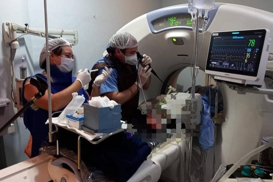 Realizaron en Concepción del Uruguay la primera fibrobroncoscopía de la provincia